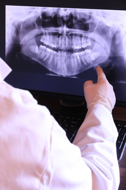 Best Root Canal Emergency Dentist  in Centerville, IA