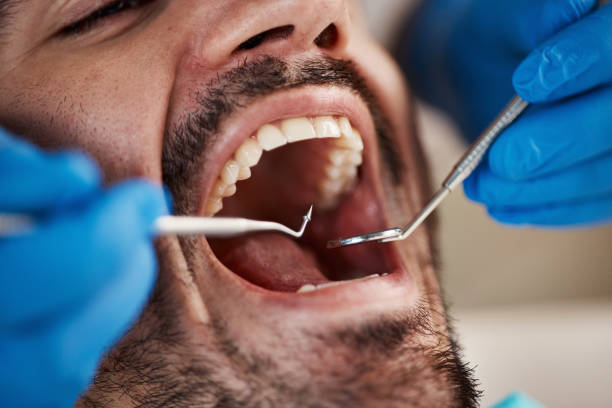 Best Broken Tooth Emergency  in Centerville, IA